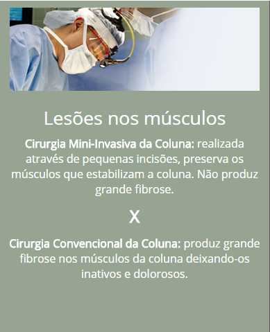 lesoes-nod-musculos